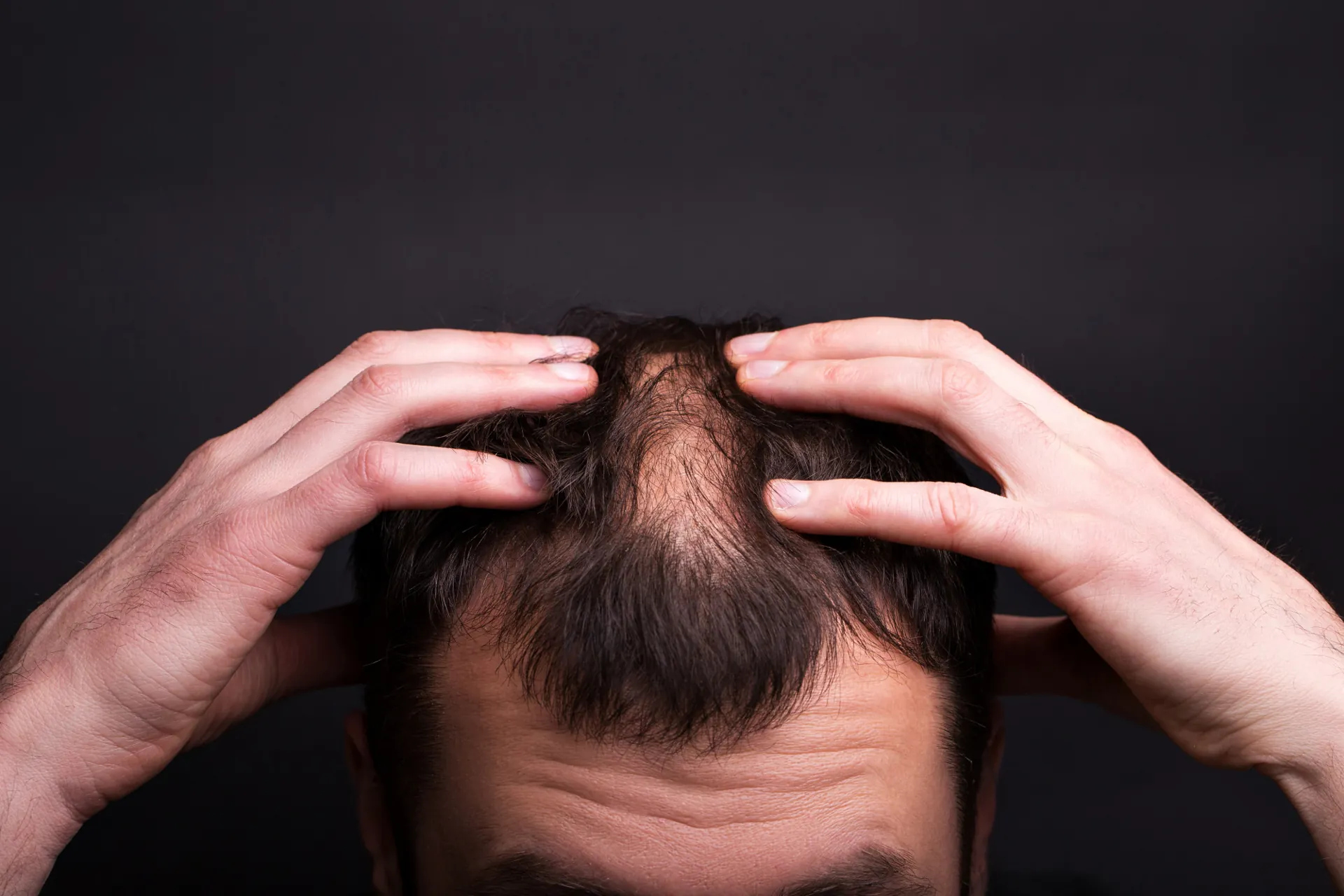 Gros plan sur un homme qui perd des cheveux devant un mur noir.